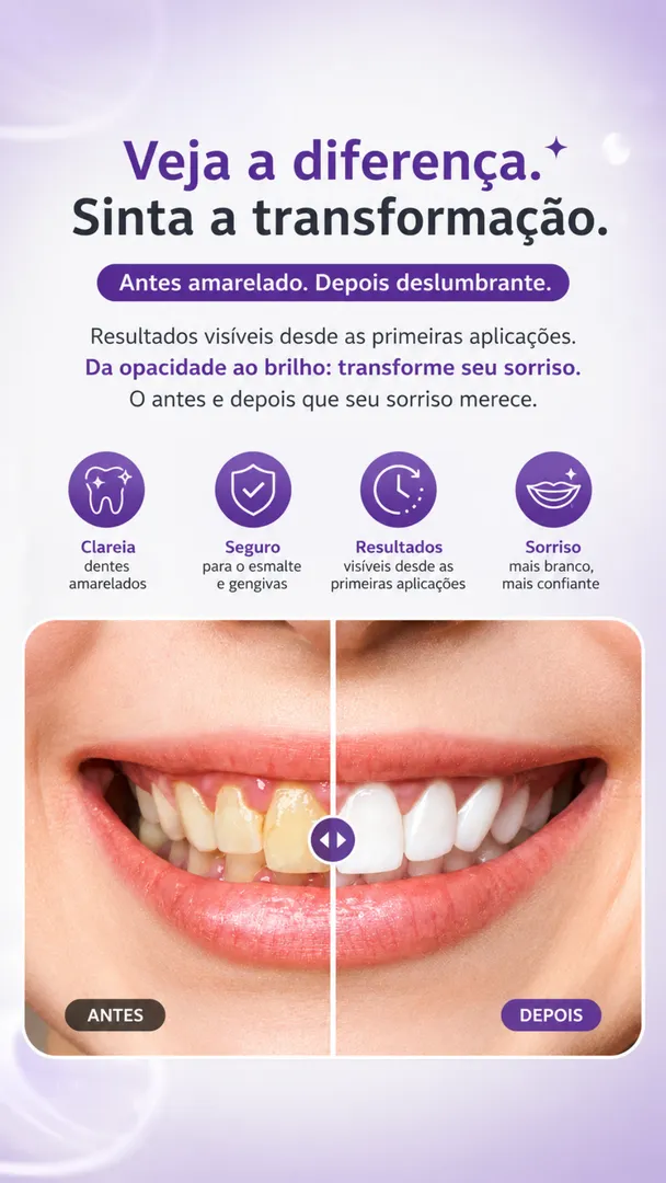 Kit Clareador Dental Whiteness Simple FGM com 2 Seringas + Moldeira 3